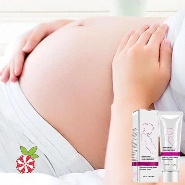 Maternity Stretch Marks Removal Cream - Image 2