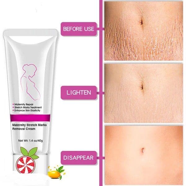 Maternity Stretch Marks Removal Cream - Image 3