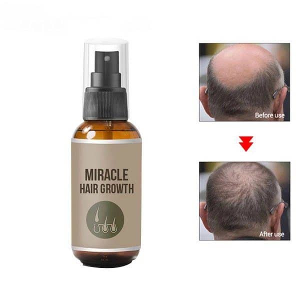 MIRACLE HAIR GROWTH SPRAY - Image 4