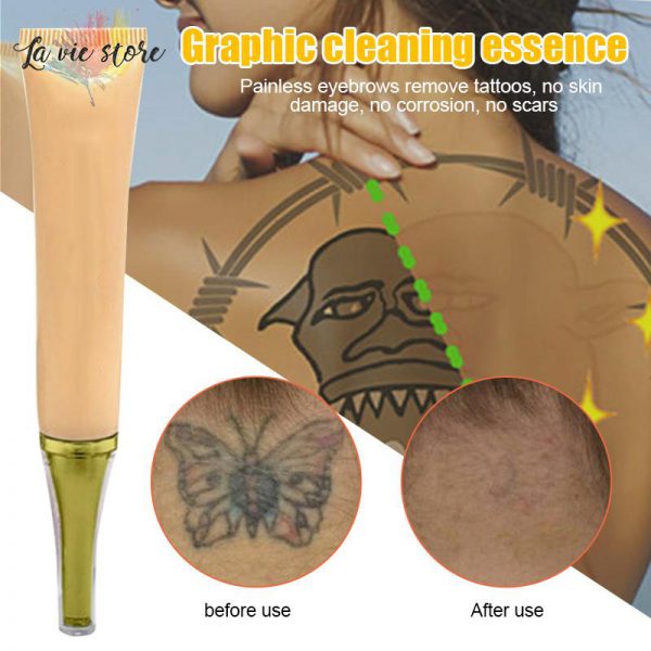 permanent tattoo removal cream