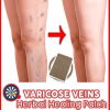 Varicose Veins Herbal Healing Patch