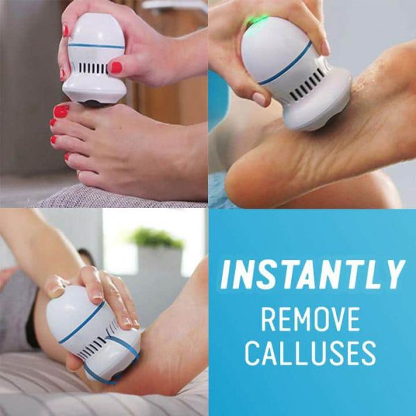 CareFoot™ Electric Dead Skin Remover