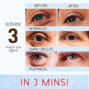 Revitaleyes™ Repair Eye Cream