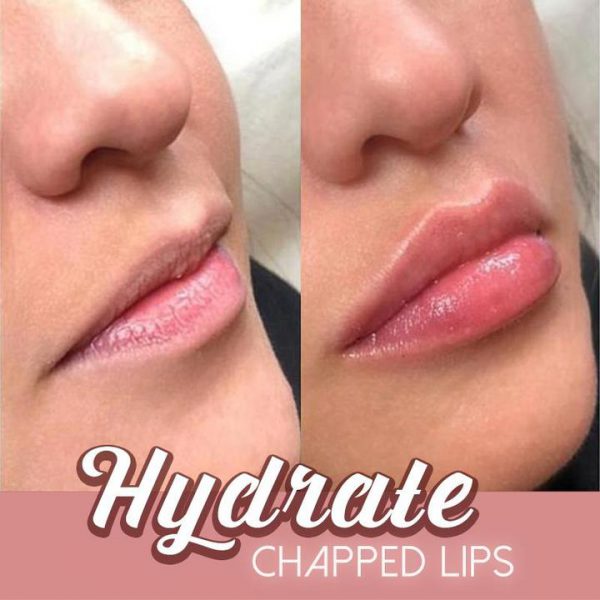 5 Mins Extreme Lip Plumper - Image 4