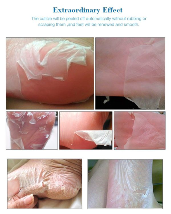 Ultimate Foot Peeling Mask - Image 3