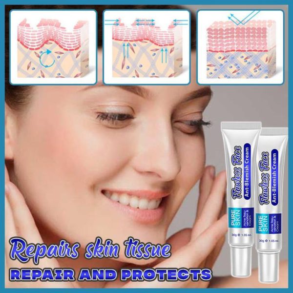 Perfect Skin Anti-Blemish Cream - Image 2