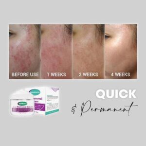 Medease™ Skin Rebound Cream