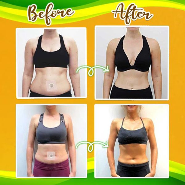 BellyGo™️ Herbal Slimming Waist Pellet