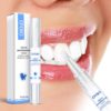 Magical Teeth Whitening Pen