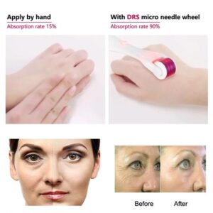 Derma Roller - New Anti-age Needling Technology