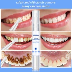 Magical Teeth Whitening Pen