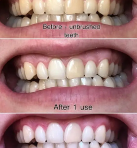 Magical Teeth Whitening Powder