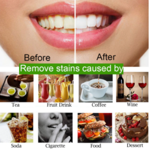 Magical Teeth Whitening Powder