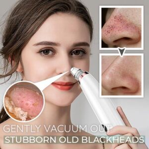 Dermation™ Vacuum Suction Pore Cleanser