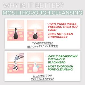 Dermation™ Vacuum Suction Pore Cleanser