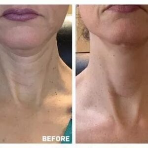 SPECIAL SALE-50%OFF💋 Advanced Neck Firming Cream