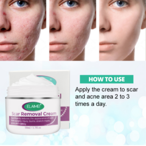 🔥BUY 2 GET 1 FREE🔥Scarless Skin Rebound Cream