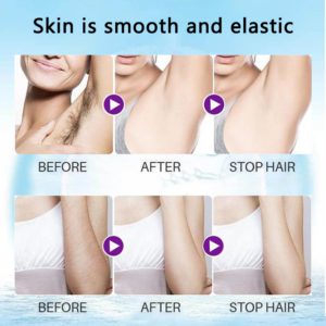 （🔥Hot Summer Sale - 50% OFF）2021 Magical Hair Inhibitor & Hair Removal💝BUY 1 GET 1 FREE!!