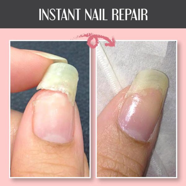 🔥🔥BUY 1 GET 1 FREE-Nail Repair Protection Gel