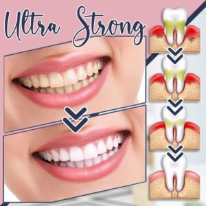 StainGone™ Teeth Whitening Toothpaste