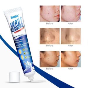 Instant Blemish Removal Gel（Limited Time Discount 🔥 Last Day）