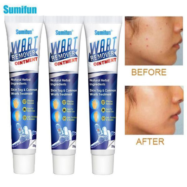 Instant Blemish Removal Gel（Limited Time Discount 🔥 Last Day）