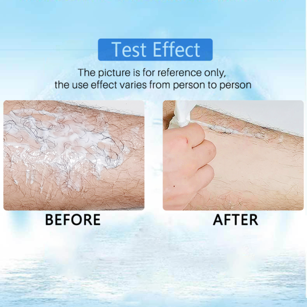 🔥 2021 Magic Hair Removal & Hair Inhibitor【Buy 5+ Get Extra 25% OFF】