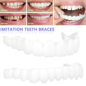 🔥50% OFF🔥 Magic Smile Teeth Brace 💝BUY 1 GET 1 FREE!