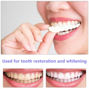 🔥50% OFF🔥 Magic Smile Teeth Brace 💝BUY 1 GET 1 FREE!