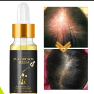 ✔Biotin Thickening Herbal Serum - SUMMER HOT SALE