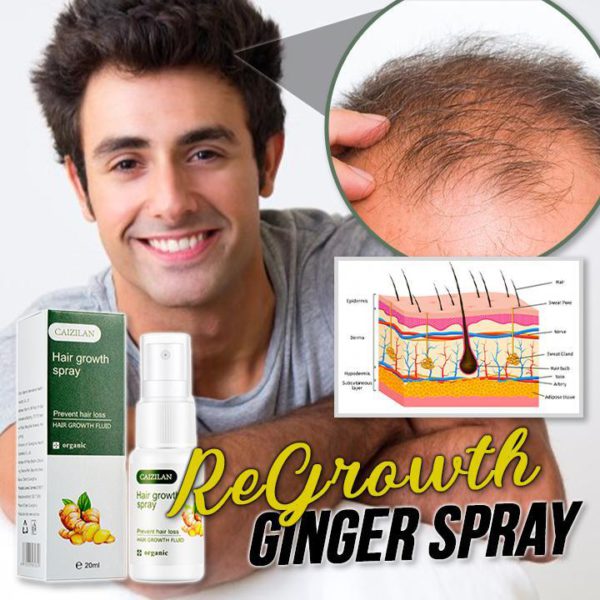 (Summer Sale - 50% OFF)ReGrowth Ginger Spray