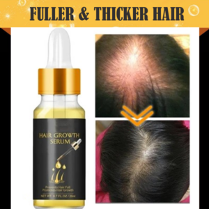 (Last Day Promotions-50% OFF)Biotin Thickening Herbal Serum