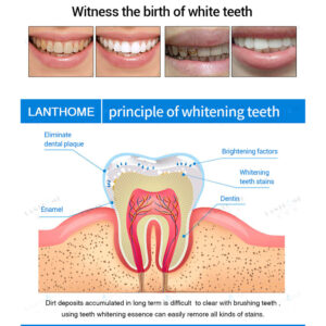 MID-YEAR LIMITIED SALE - 45% OFF💖LANTHOME™ TEETH WHITENING PENS🎁