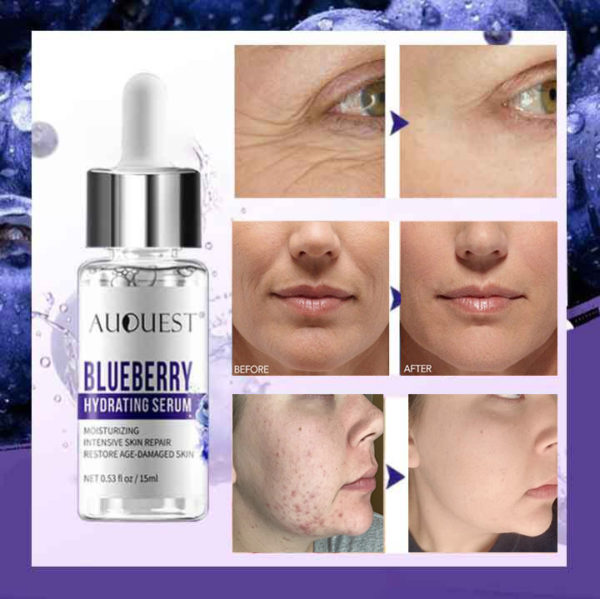 🔥Buy 1 Get 1 Free--AUQUEST™ 2021 New Blueberry Instant Wrinkle Essence