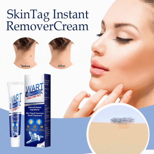 （🔥Hot Summer Sale - 50% OFF）SkinTag Instant Remover Cream💝BUY 1 GET 1 FREE!!