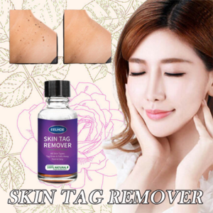 [SUMMER HOT SALE] Instant freckle removing essence