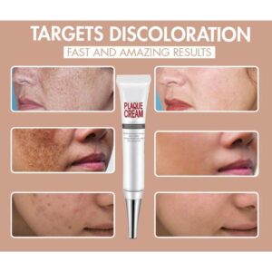 [SUMMER HOT SALE] Repair Fade Freckles Remove Dark Spots Face Cream