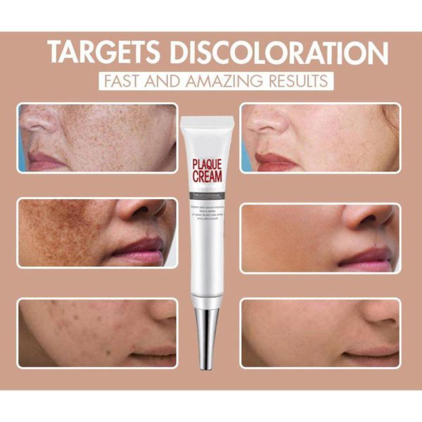 [SUMMER HOT SALE] Repair Fade Freckles Remove Dark Spots Face Cream