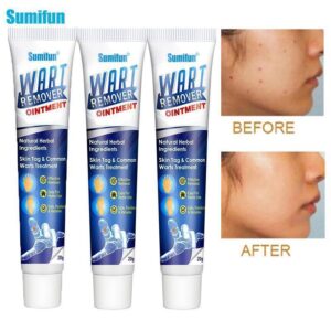 🔥Limited time discount 🔥 last day）Instant Blemish Removal Gel