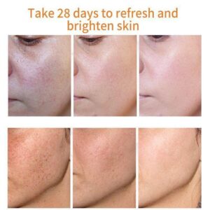 [SUMMER HOT SALE] Repair Fade Freckles Remove Dark Spots Face Cream