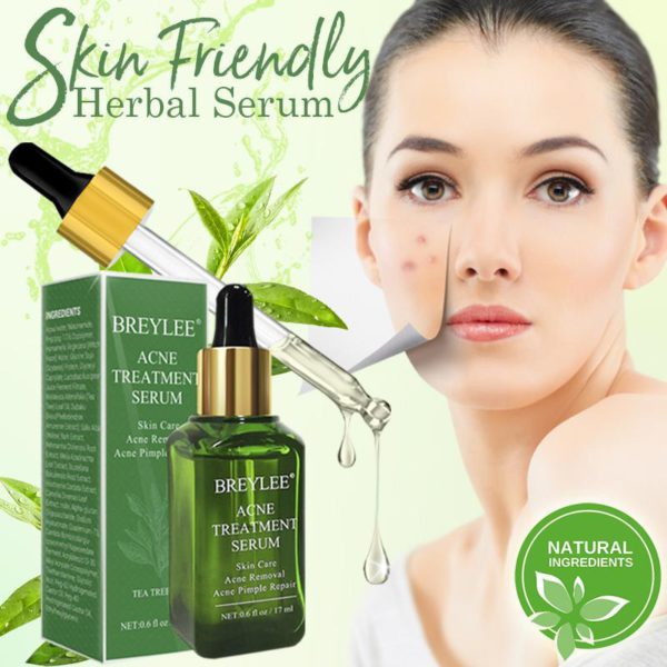 AcneAway Herbal Serum