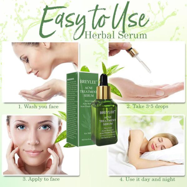 AcneAway Herbal Serum