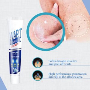 （🔥Hot Summer Sale - 50% OFF）SkinTag Instant Remover Cream💝BUY 1 GET 1 FREE!!