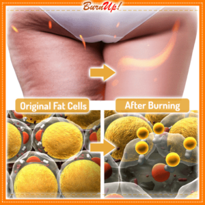 BurnUp! Cellulite Heating Spray