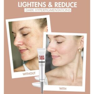 [SUMMER HOT SALE] Repair Fade Freckles Remove Dark Spots Face Cream