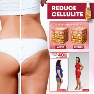 BurnUp! Cellulite Heating Spray