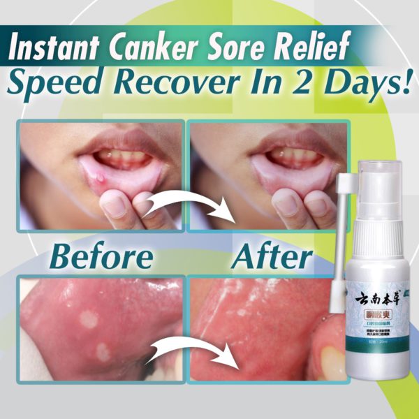 Mouth And Throat Sore Oral Spray