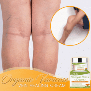 Organic Healing Cream for Varicose Vein