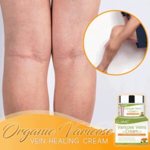 Organic Varicose Vein Healing Cream