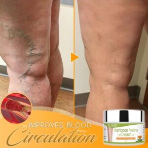 Organic Varicose Vein Healing Cream